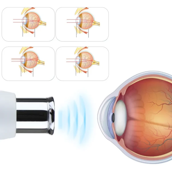 Ultrasonic Vibration Monitor Restore Eyesight for Kid - Image 2