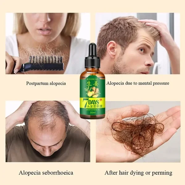 Ginger Hair Growth Spray Serum - Image 2