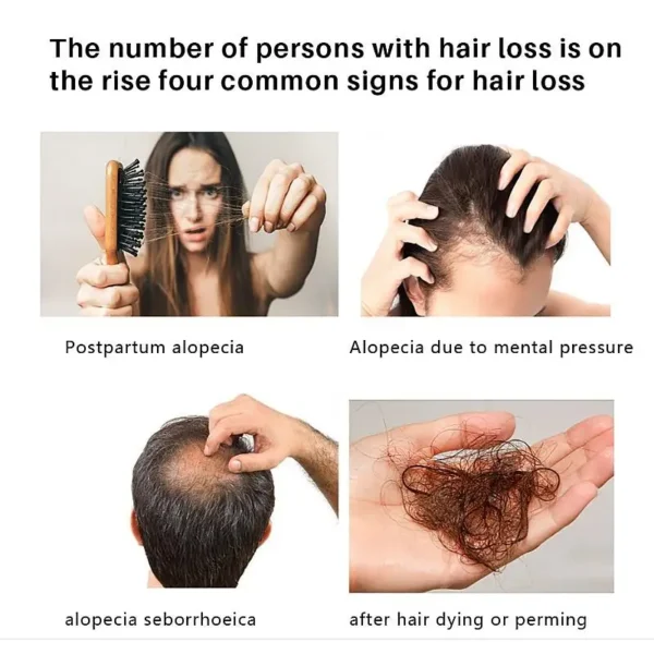 Ginger Hair Growth Spray Serum - Image 3