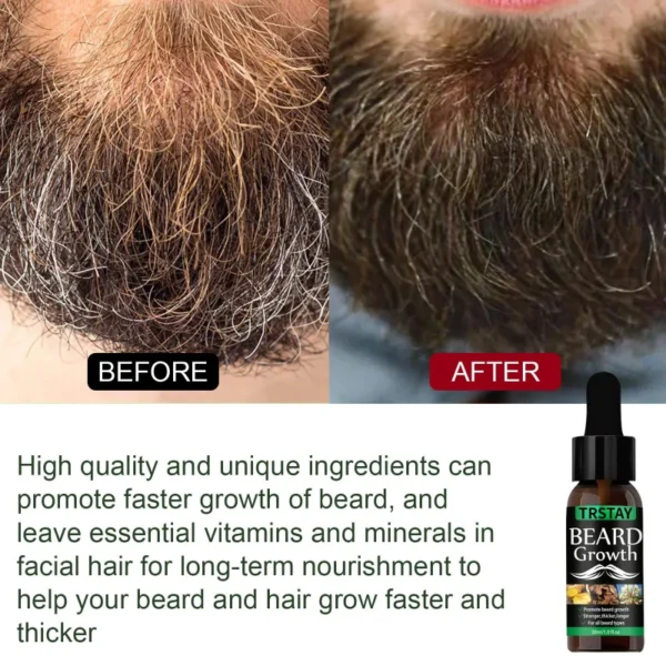 Beard Hair Growth Essential Oil - Image 3